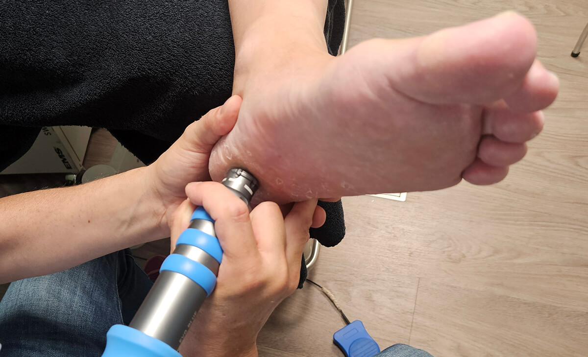 Shockwave therapie bij hielspoor